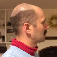 Check spelling or type a new query. Do Less Dad On Twitter Act The Part Dolessdad Doless Dad Haircut Barber Hairstyles Hair Sideburns Bald Https T Co Shnbu0ebnp