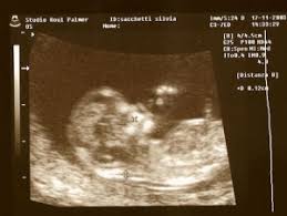 Si tratta di un periodo estremamente. Terzo Mese Di Gravidanza Mammaimperfetta