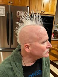 Today was a strange day for me. One year ago today I started my  chemotherapy treatments, for stage 4 sarcoma cancer. Three 76 hour  infusions of dual chemos and then two 2