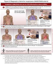 Anaphylaxis is a severe, sudden allergic reaction to an allergen such as a food, insect bite, medication, or latex. Anaphylaxis Angioedema Practical Approach To Diagnosis And Management In Emergency Department Recapem
