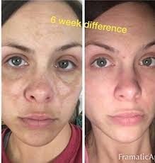 Knowing some of the best selling dark spot corrector in the drugstores may make it easier for you to look for a good product. Best Drugstore Dark Spot Corrector Reviews 2019 That Works