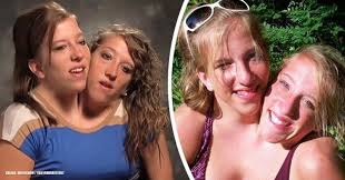Abby & brittany hensel are two vivacious, funny and outgoing girls on the brink of their 22nd birthday and a quickly approaching college graduation. Worldwide Famous Conjoined Twins Opened Up About Their Love Life