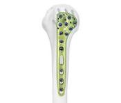 Proximal Humeral Locking Plate Ⅲ,Medical Device ...