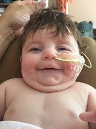 Truncus arteriosus — Shirley's Grand Adventure Blog — Shirley's Grand  Adventure