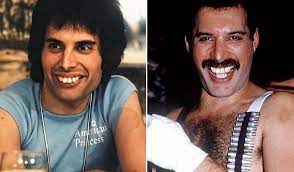 How Freddie Mercury Looks Like If He Would Fix His Teeth Here S The Answer Freddie Mercury Freddie Mercury Teeth Mercury