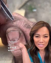 Dr Sandra Lee aka drpimplepopper