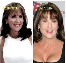 Phil's wife before and after pictures. Dr Phil Might Need To Do An Intervention On His Wife Soon R Botchedsurgeries
