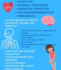 Image result for Relapsing Polychondritis