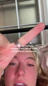 Experiences with Oura Ring Stress Tracking