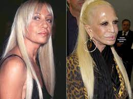 Check out these 13 examples of plastic surgery gone wrong: Top 20 Celebrity Plastic Surgery Gone Wrong Photos Before After Viral Newsman