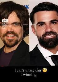 Peter Dinklage from Game of Thrones is Adrian's long lost triplet. :  r/MAFS_AU