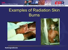 She was born in a small. Attack On A Nuclear Power Plant Ppt Download