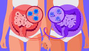 Maybe you would like to learn more about one of these? Colon Cleansing No You Don T Need A Bowel Cleanse Or Gut Cleanse