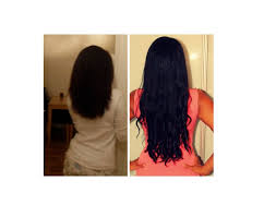 These 8 vitamins are vitamin b1, vitamin b2, vitamin b3, vitamin b5, vitamin b6, vitamin b7, vitamin b9 and vitamin b12, which work as a hair growth stimulant and also control the tissue synthesis process. Msm Hair Growth Before And After Pictures Msm Powder Oil Results