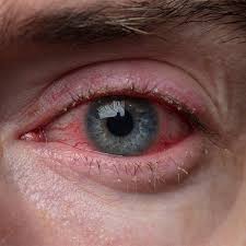 Image result for Blepharis affinis