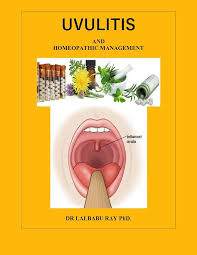 Image result for Uvulitis