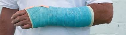 Image result for Hand Fracture