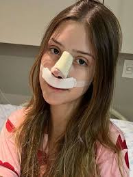Estrela do TikTok, Liz Macedo faz rinoplastia aos 14 anos e lamenta pressão  estética: Ninguém vai te amar se não for atraente