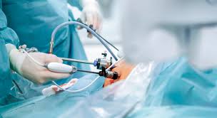 Cirugía de pérdida