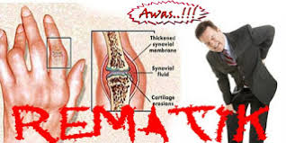 Cara membuat minyak kemiri juga cukup mudah karena bisa dilakukan dengan cara tradisional. Obat Rematik Buat Sendiri Dan Keluarga Obat Rematik Alam Alami