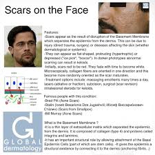 Brad pitt pitt is one of the biggest heartthrobs in hollywood, but his skin doesn't always look perfect (shocking, we know). Global Dermatology Acne Scars Instagram