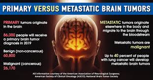 Cancer that starts elsewhere in the body and then moves into the brain is called a metastatic brain tumor. May Is Brain Cancer Awareness Month Conquer The Patient Voice