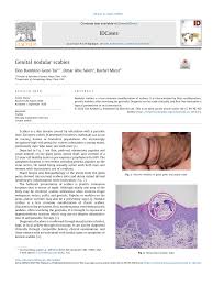Image result for scabies on genitals