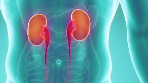 Chronic kidney disease, also known as chronic renal failure, chronic renal disease, or chronic kidney failure, is much more widespread than people realize; Chronic Kidney Disease And Its Natural Treatment Dr Rath Health Foundation