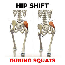James Lu Rmt To On Instagram How To Correct Hip Shift During Squats Hip Shift Also Known As Lateral Pelvic Tilt Is W Pelvic Tilt Squats Hips