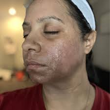 TOP 10 BEST Laser Hair Removal for Men in Plano, TX