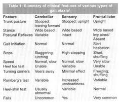 Image result for Romberg Test