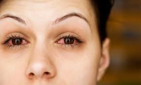 How Does Sinus Affect Your Eyes Health Wellness Spec Savers South Africa