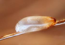 Then, vacuum the area, if possible, to remove any dead lice. Create Meme Lice Nits Larvae Lice And Nits Lice Nits Eggs Pictures Meme Arsenal Com