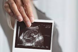 Tiub ini seterusnya akan membentuk tulang belakang dan otak bayi. Ibu Hamil Bakal Berdepan Risiko Kelahiran Pramatang Terencat Jika Tidak Ambil Asid Folik