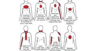How To Recognize Heart Attack Symptoms One Month Ahead Heart Attack Symptoms Signs Of Heart Attack Heart Attack