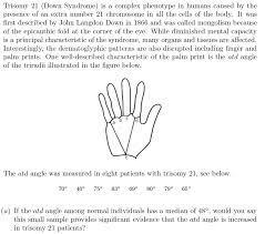 Solved Trisomy 21 Down Syndrome Is A Complex Phenotype Chegg Com
