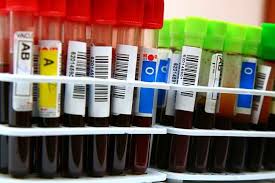 Antigen h adalah precursor dari system abo tetapi diproduksi oleh suatu chromosom tempat berbeda. Memahami Karakteristik Golongan Darah A B Ab Dan O Alodokter