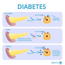 While it can be diagnosed in people who are over 40 years old, this is very rare. Diabetes All You Need To Know L Dr Seb