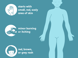 Jock itch is typically easy to treat, but some cases can grow out of control or become resistant to treatment. Ringworm Signs Symptoms And Complications
