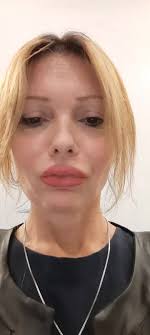 colazione #hotel #Artemide #roma