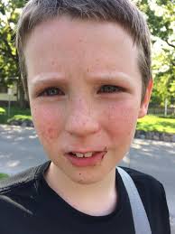 How does Westfield schools allow such a bully into to their schools? He  shared this post agreeing with this imbecile post. How does Westfield and  Christians who call him Pastor not see