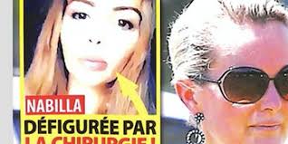Nabilla benattia a usé de quelques opérations de chirurgie esthétique pour atteindre sa plastique qui fait rever plus d'un homme. Nabilla Benattia Defiguree Par La Chirurgie