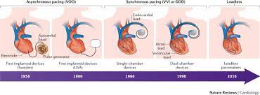 A pacemaker is a small device that's placed under the skin in your chest to help control your implanting a pacemaker in your chest requires a surgical procedure. Next Generation Pacemakers From Small Devices To Biological Pacemakers Nature Reviews Cardiology