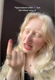 Albino Daddy Long Legs