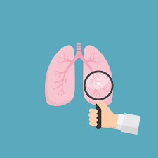 What are lung cancer symptoms and signs? Egfr Advanced Lung Cancer Treatment Options Survival Rate Parkway Cancer Centre Uae