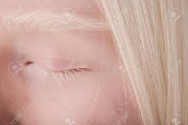 白い眉毛とまつげを持つ自然の美しさを持つアルビノの女の子の接写の写真素材・画像素材 Image 190866407
