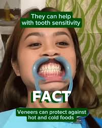 Dental veneers can be a great way to improve the shape, size, or texture of  your teeth and cover imperfections and transform your smile! 😃 Check out  our article