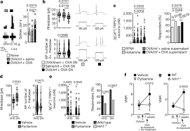 Car wheels, tyres & trims. Local Immune Response To Food Antigens Drives Meal Induced Abdominal Pain Nature