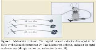Image result for Vacuum Caput