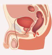Testicular Cancer | Testicular Cancer Symptoms | Medlineplus